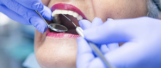 Best Emergency Dental Care for Abscessed Tooth in Ridgeland, SC